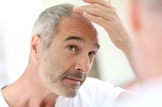 Man looking at his hair loss image